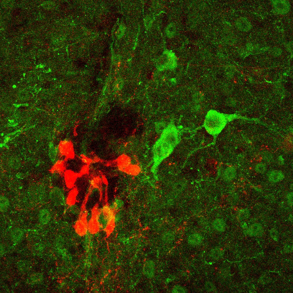 Tomato CSF-cN neurons and ChAT neuron, mouse spinal cord